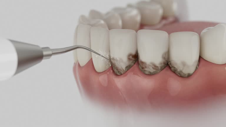 Trusted Teeth Cleaning And Checkup service in McEwen, TN - Dentist Open Now